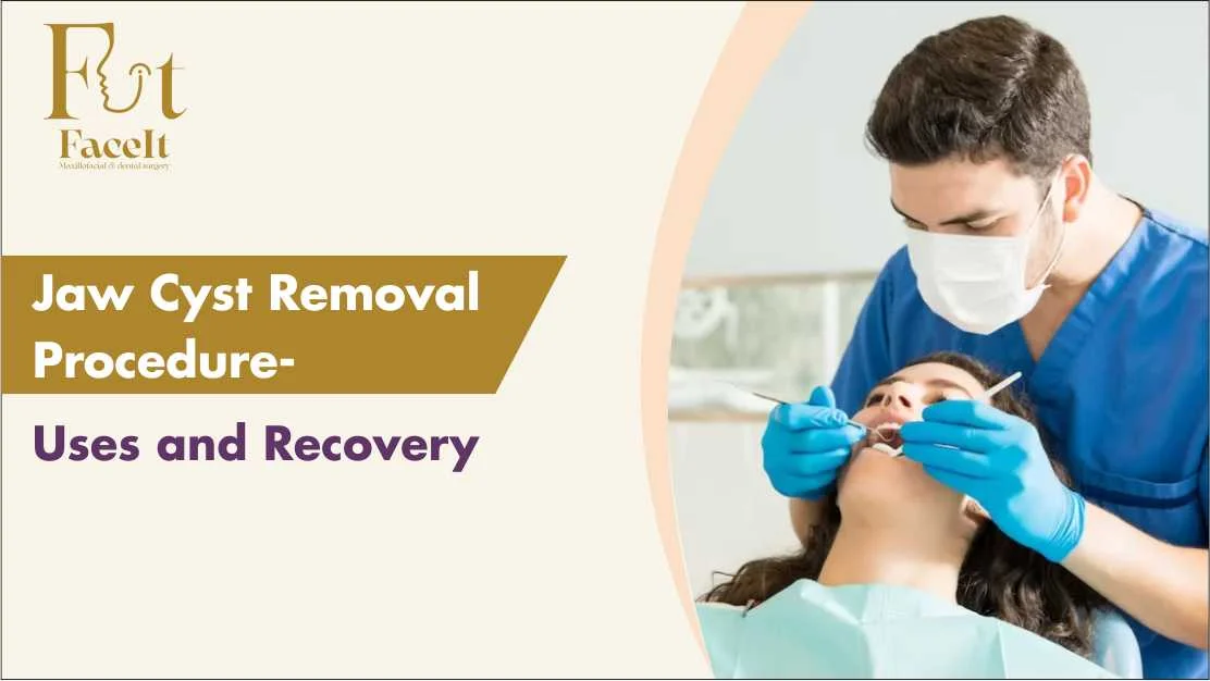 Jaw Cyst Removal Procedure - Uses & Recovery tips by Dr. Shreya Krishna